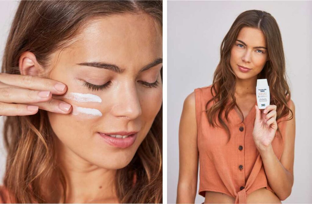 Pigmentacijske mrlje – kako spriječiti njihov nastanak i kako ih ublažiti pigmentacijske mrlje