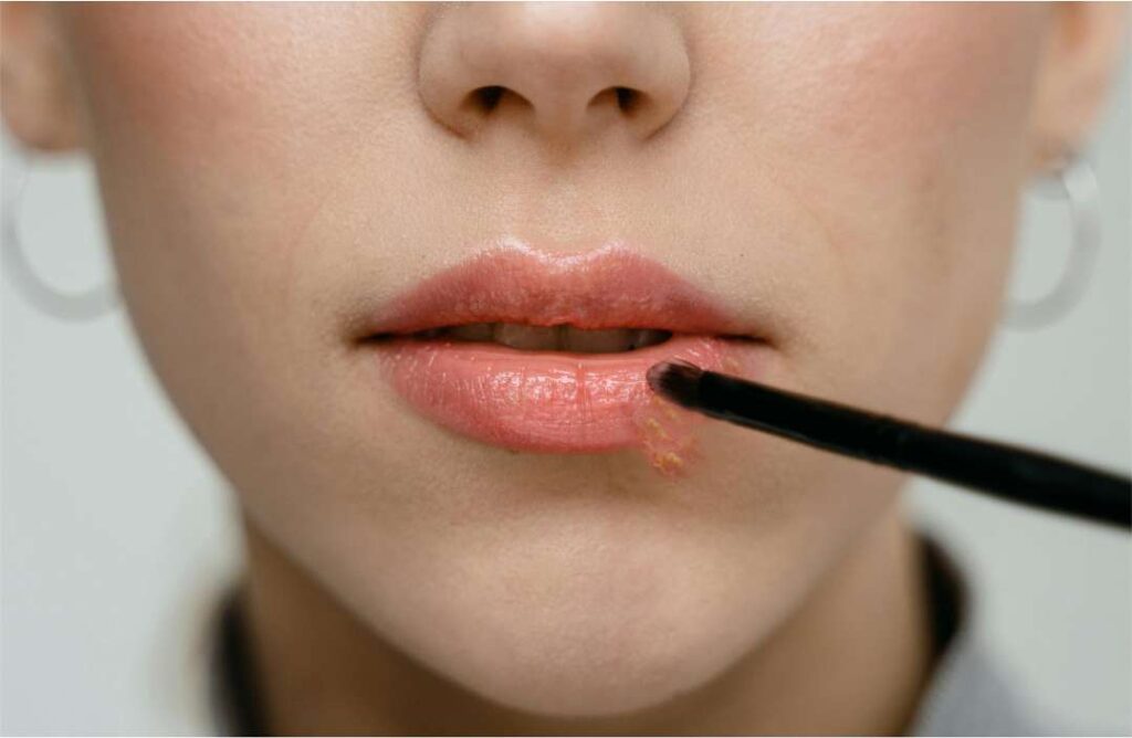 Kako brzo ukloniti herpes? Make-up trikovi ne pomažu – ali ovo da, trenutačno kako brzo ukloniti herpes tretman serumom