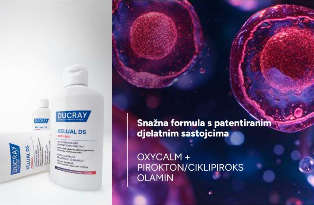 Prhut i svrbež ne biraju dob – rješenje za adolescente te žene i muškarce nudi Ducray Prhut kod adolescenata