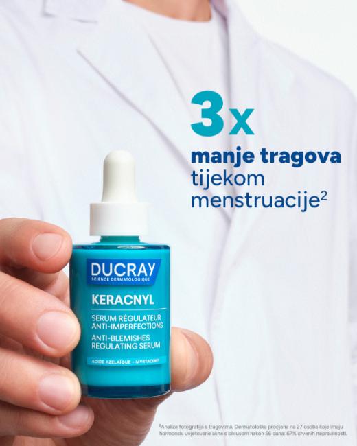 Ducray Keracnyl regulirajući serum protiv nepravilnosti