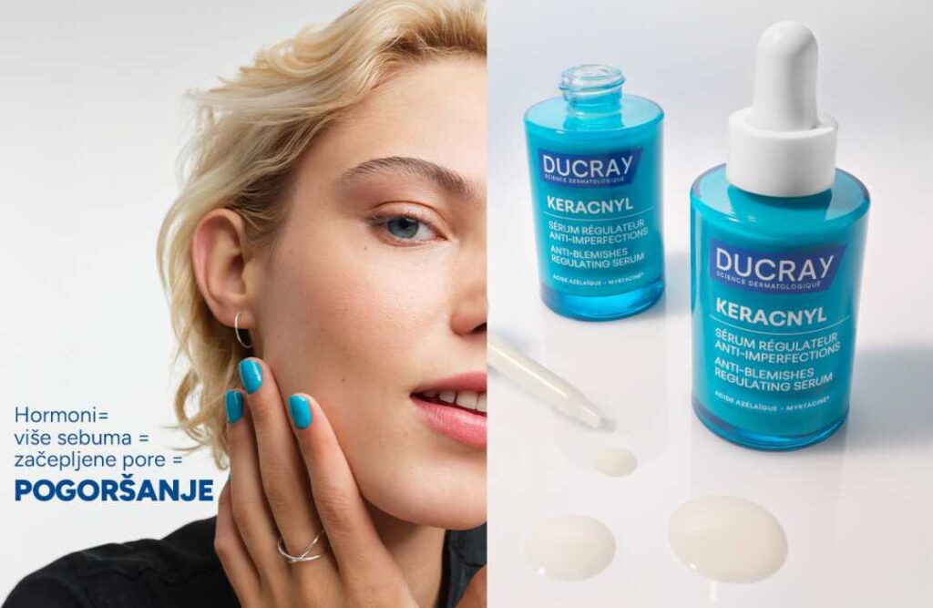 Nepravilnosti kože u odrasloj dobi